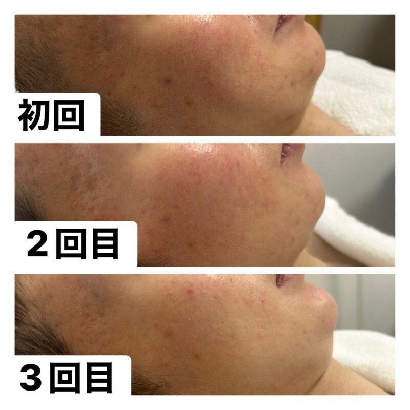 S__49184782