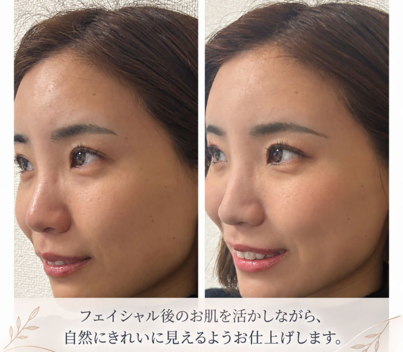 フェイシャル後の自然な美肌ビフォーアフター